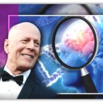 ¿Qué es la demencia frontotemporal que padece Bruce Willis y qué tan grave es?.